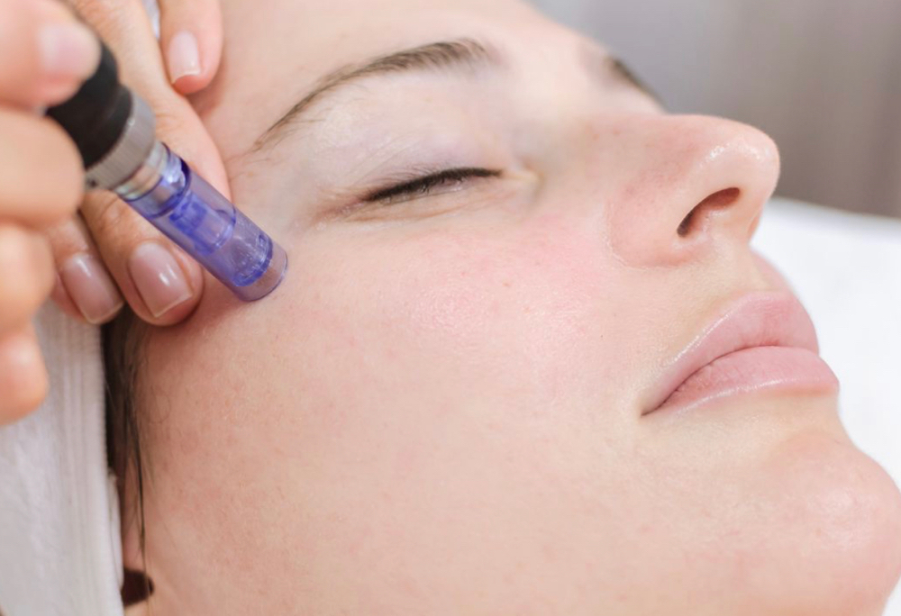 Microneedling Series