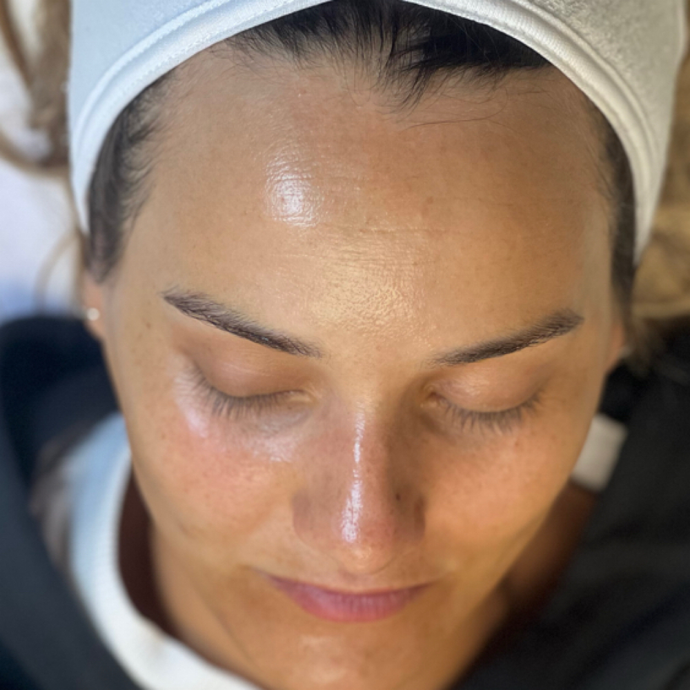 Exosomes Treatments at SiempreBellasBeautySpa in North Miami, FL