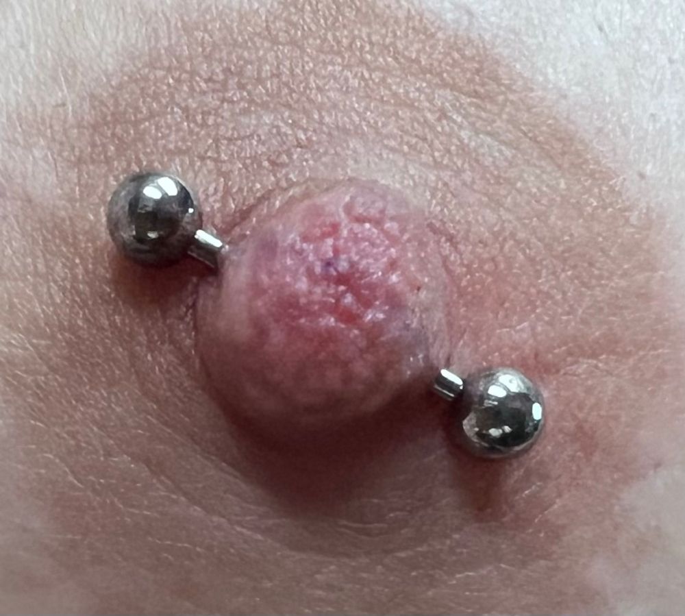 Nipple (single)