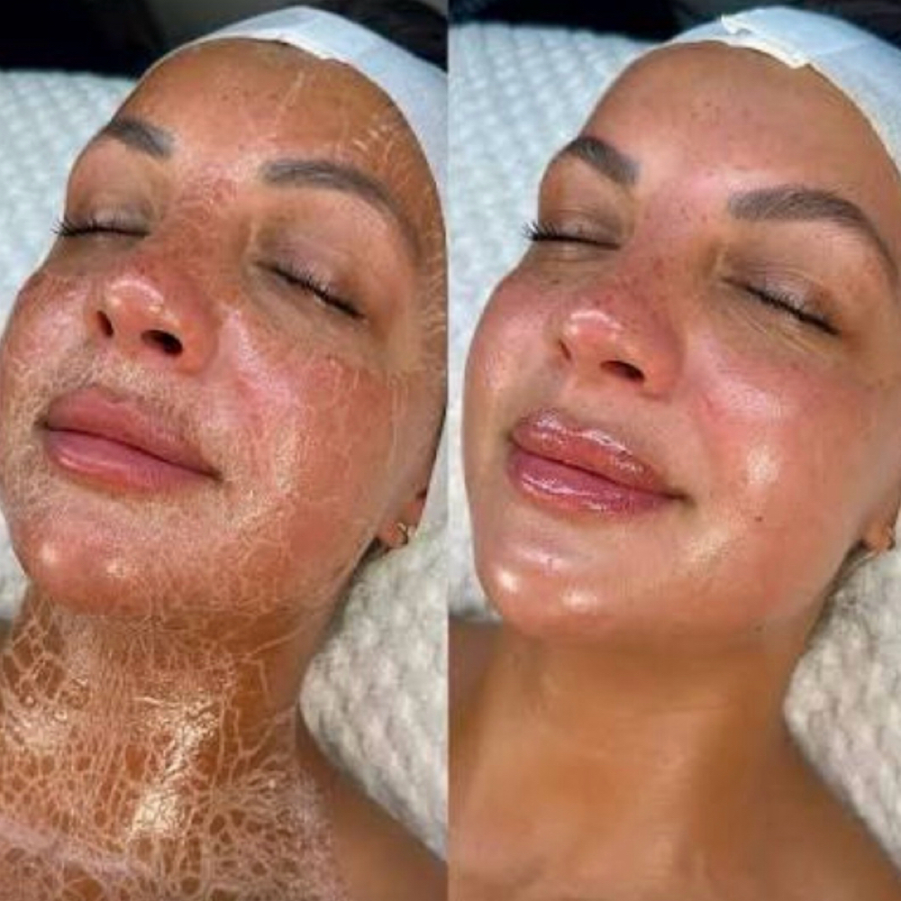 ✨ Botox Firming Peptide Facial at Thehoustonfacebar in Houston, TX