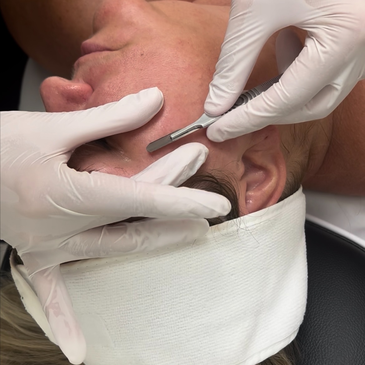 VANITY SIGNATURE + DERMAPLANE at Vanity Beauty in Saratoga Springs, NY