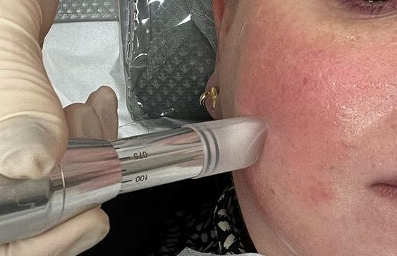 Facial Nanopore