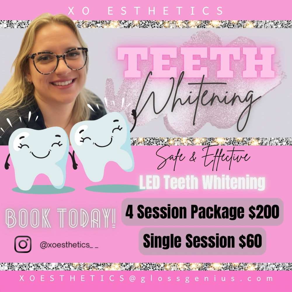 Teeth Whitening
