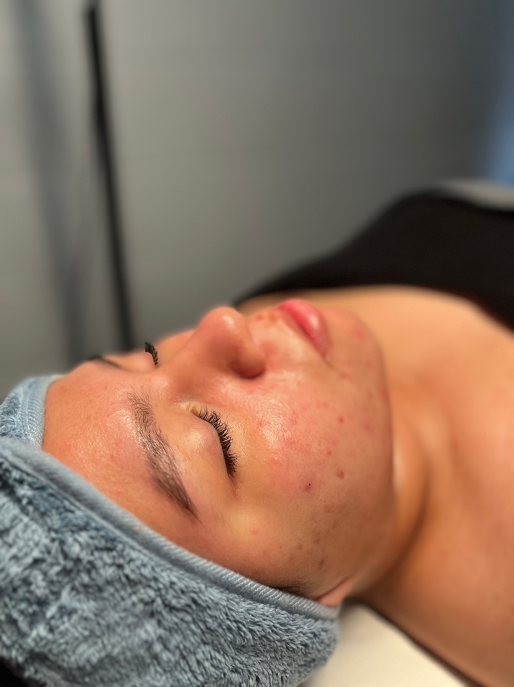 Express Facial at _skinxvanessa in Marshall, TX
