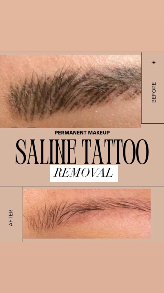 Saline Removal