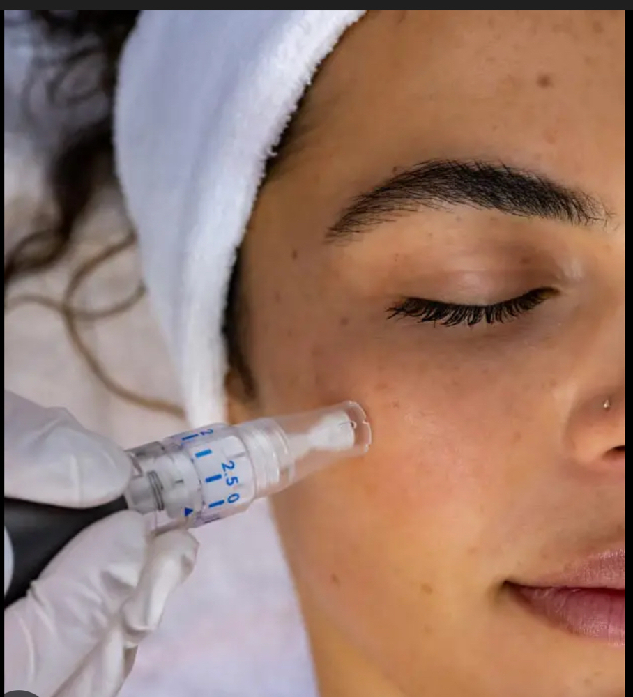Micro-needling