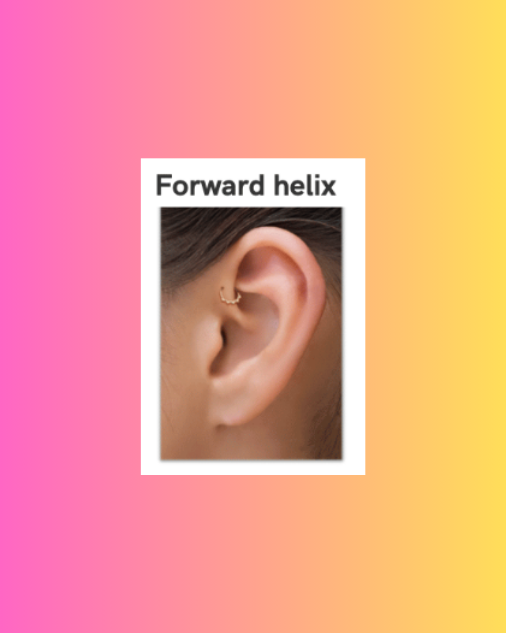 Forward Helix