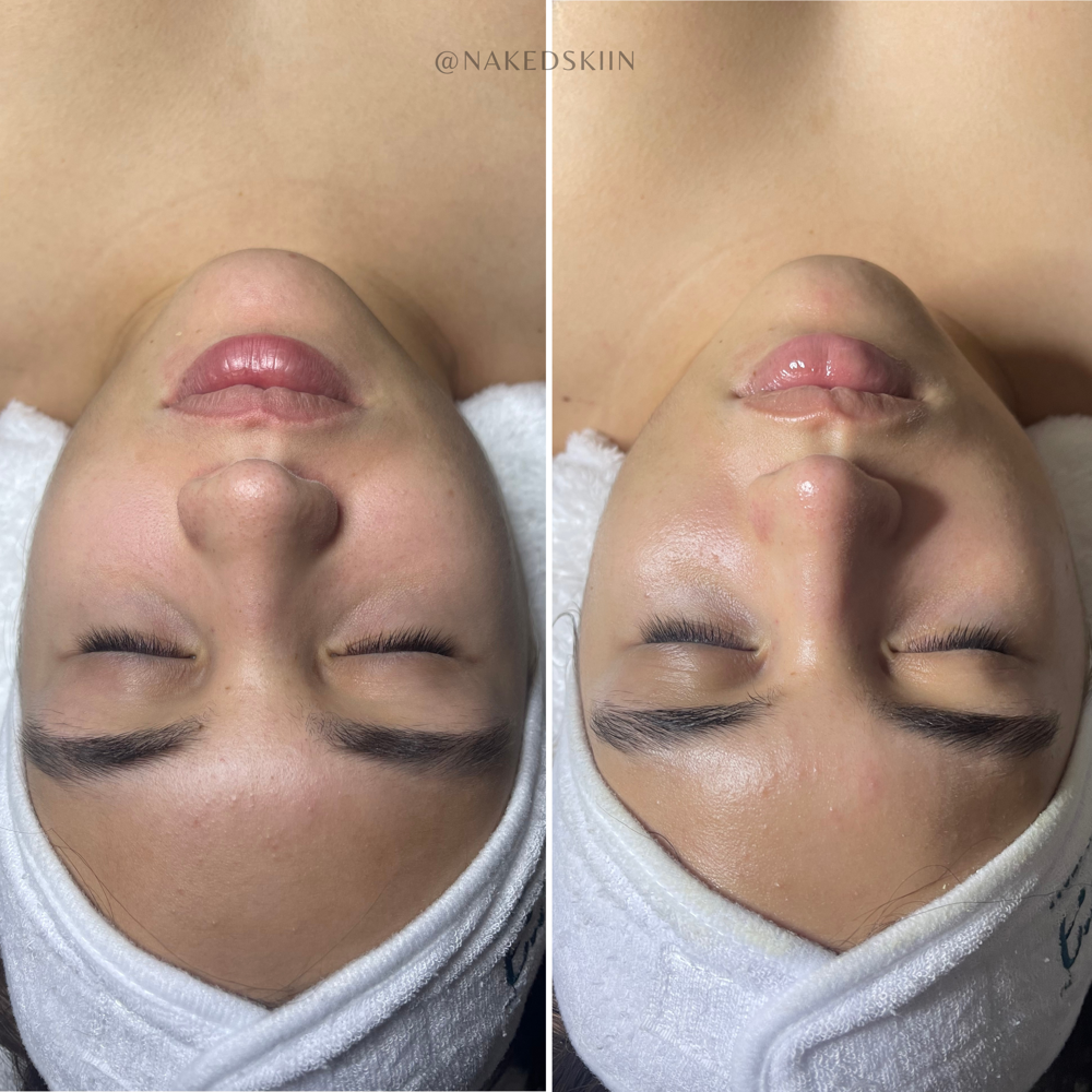 Plus Deep Cleansing Facial
