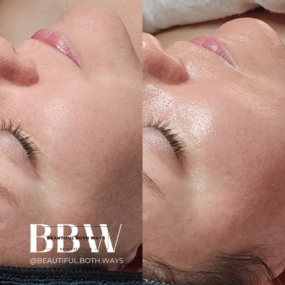 Introductory Facial