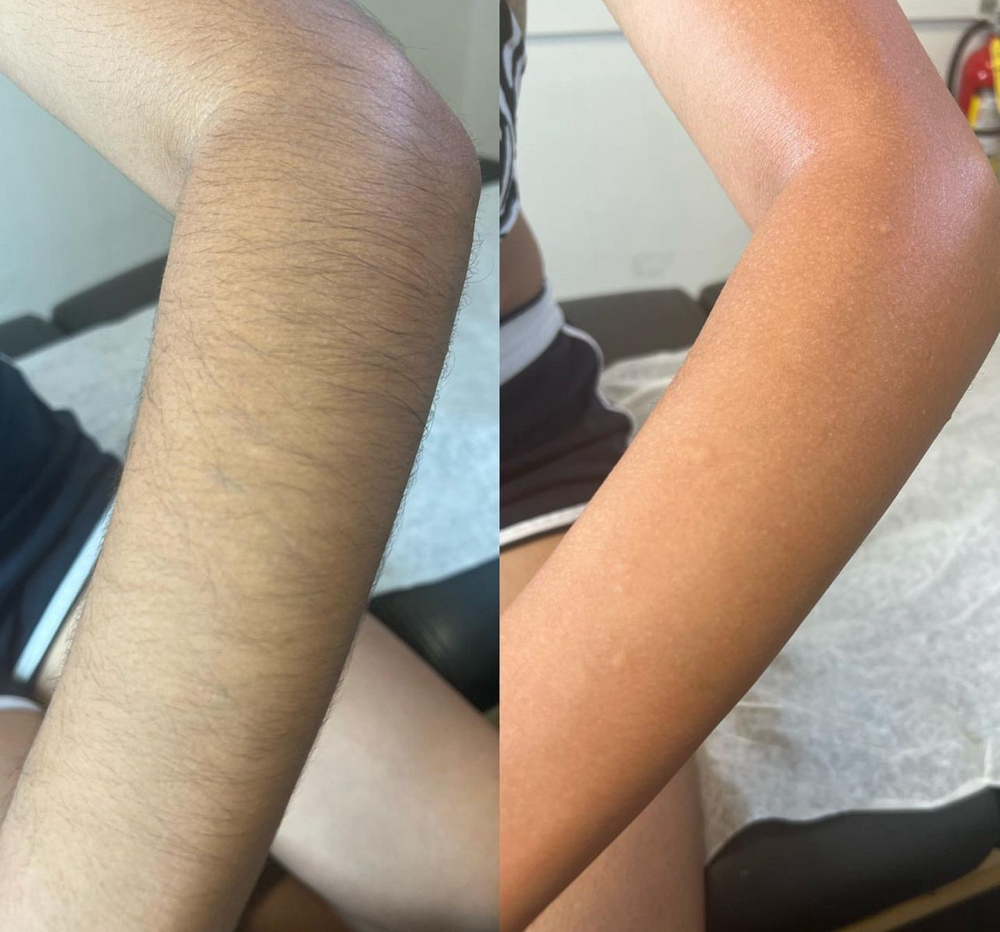Full Arms Wax