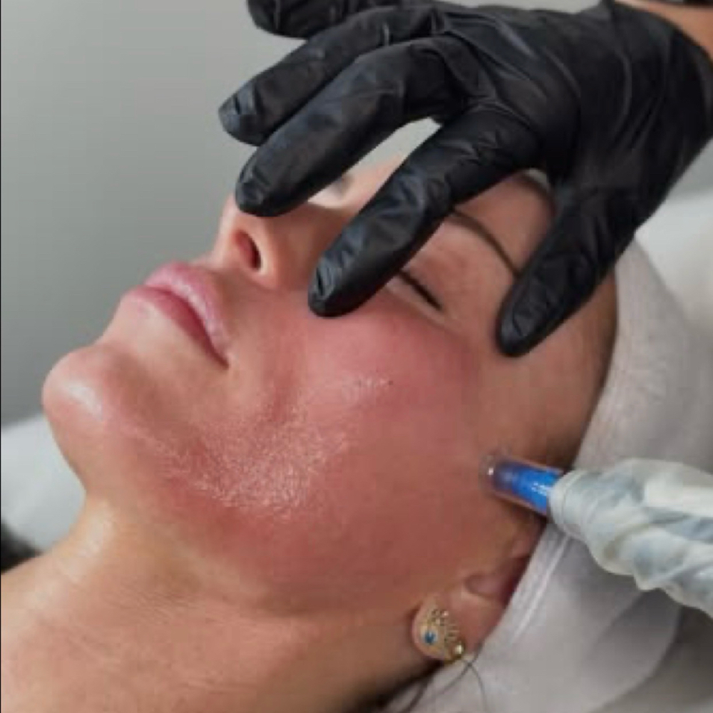 Signature Microneedling at Sage & Salt Skincare Co. in Oxford, AL