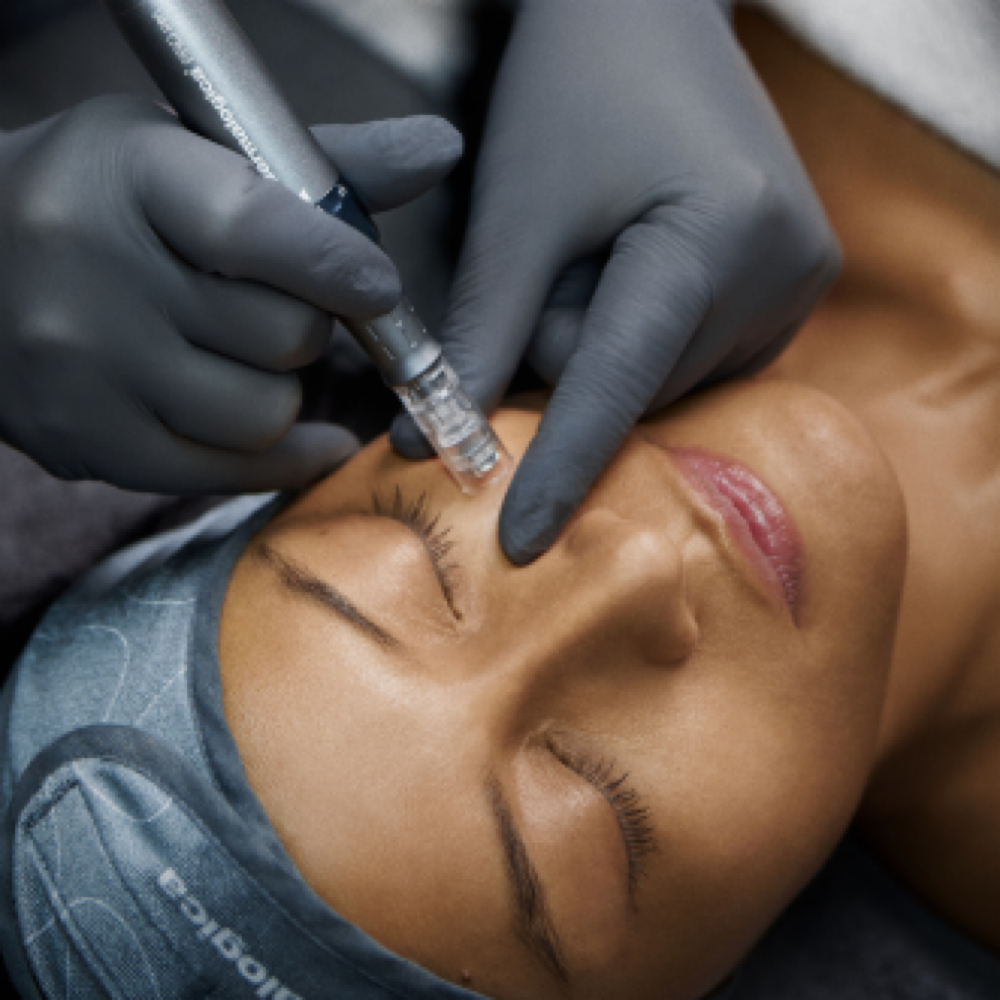 Stem Cell Facial at The Beauty Well in Hillsborough, NC