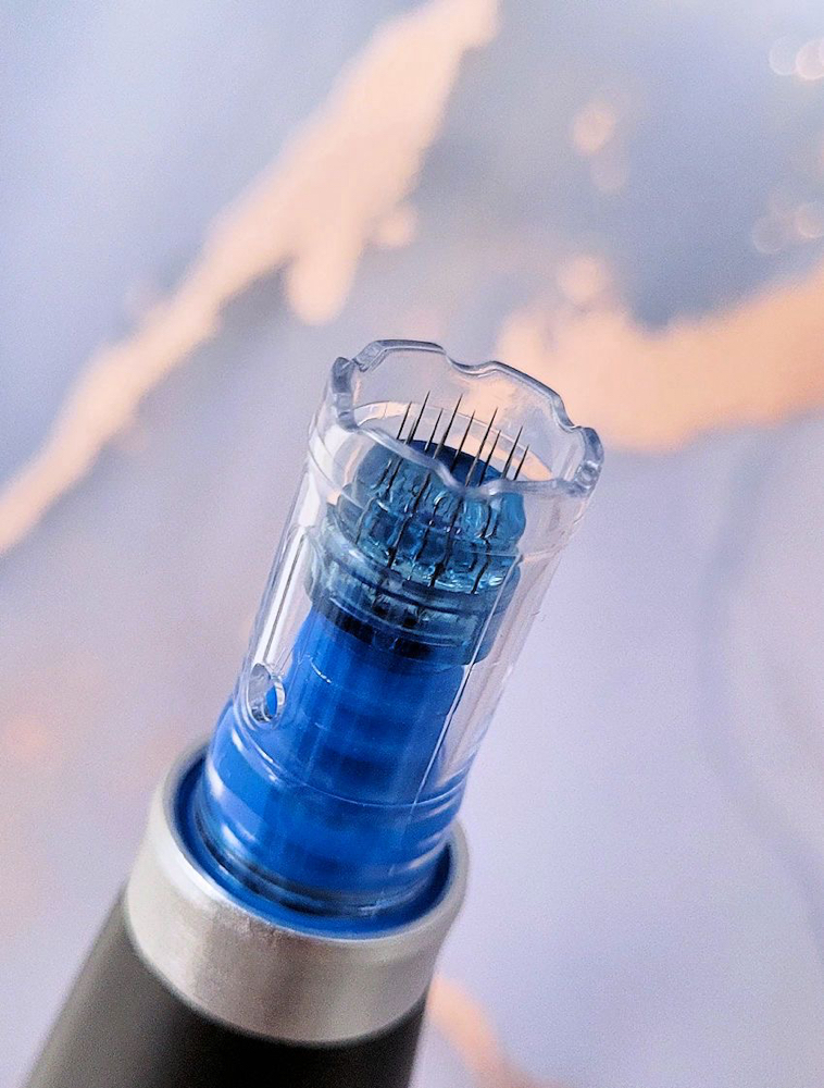 Microneedling Facial at ACK Esthetics, LLC in Naples, FL