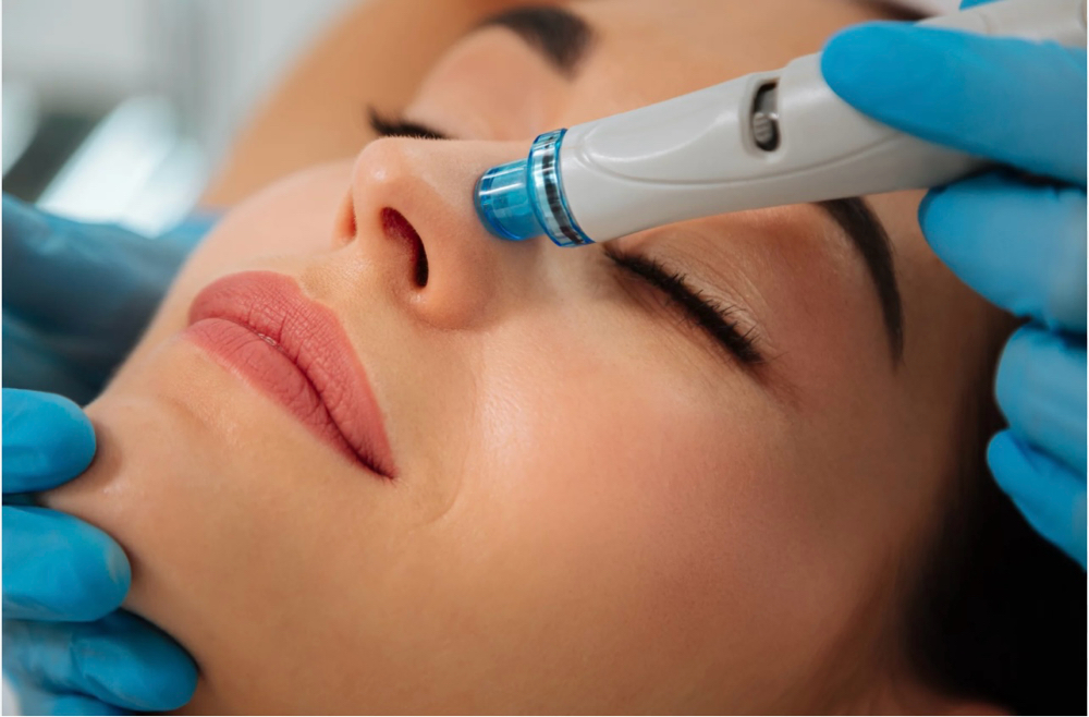 Hydrodermabrasion Facial