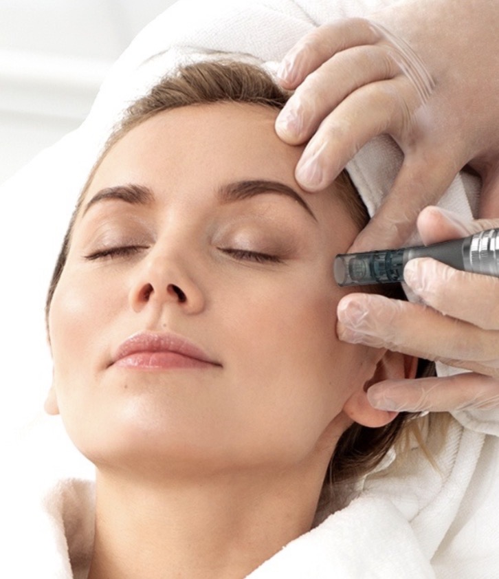 Microneedling at Luxe Serenity Studio in Asheboro, NC