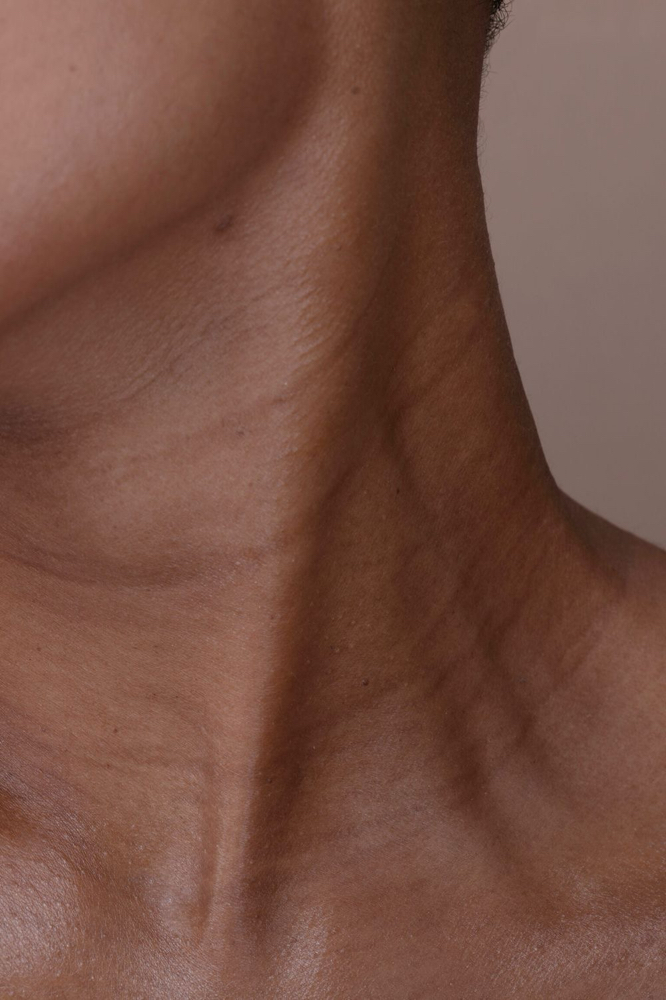 Neck Microneedling