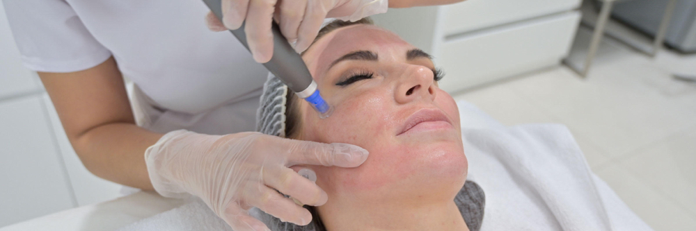 Microneedling