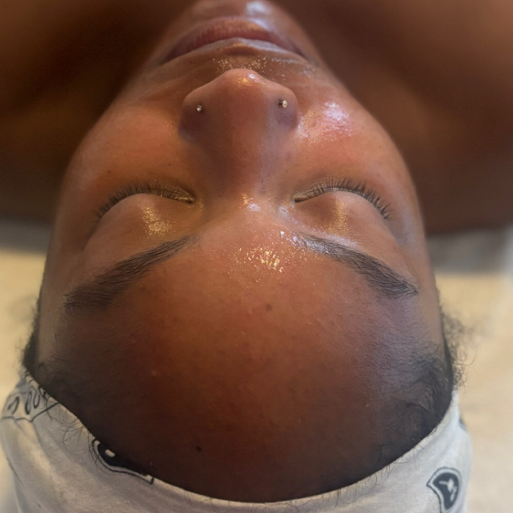 First Time Herbal Peel+Consultation at SUGARLILLIES in Sacramento, CA