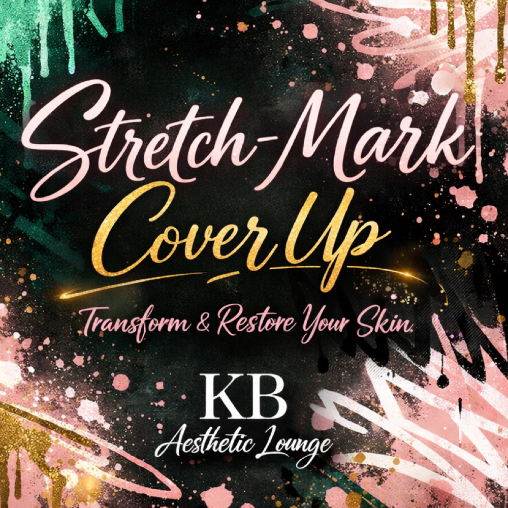 Stretch Mark Revision (SMR) at KB Aesthetic Lounge in Carmel, IN