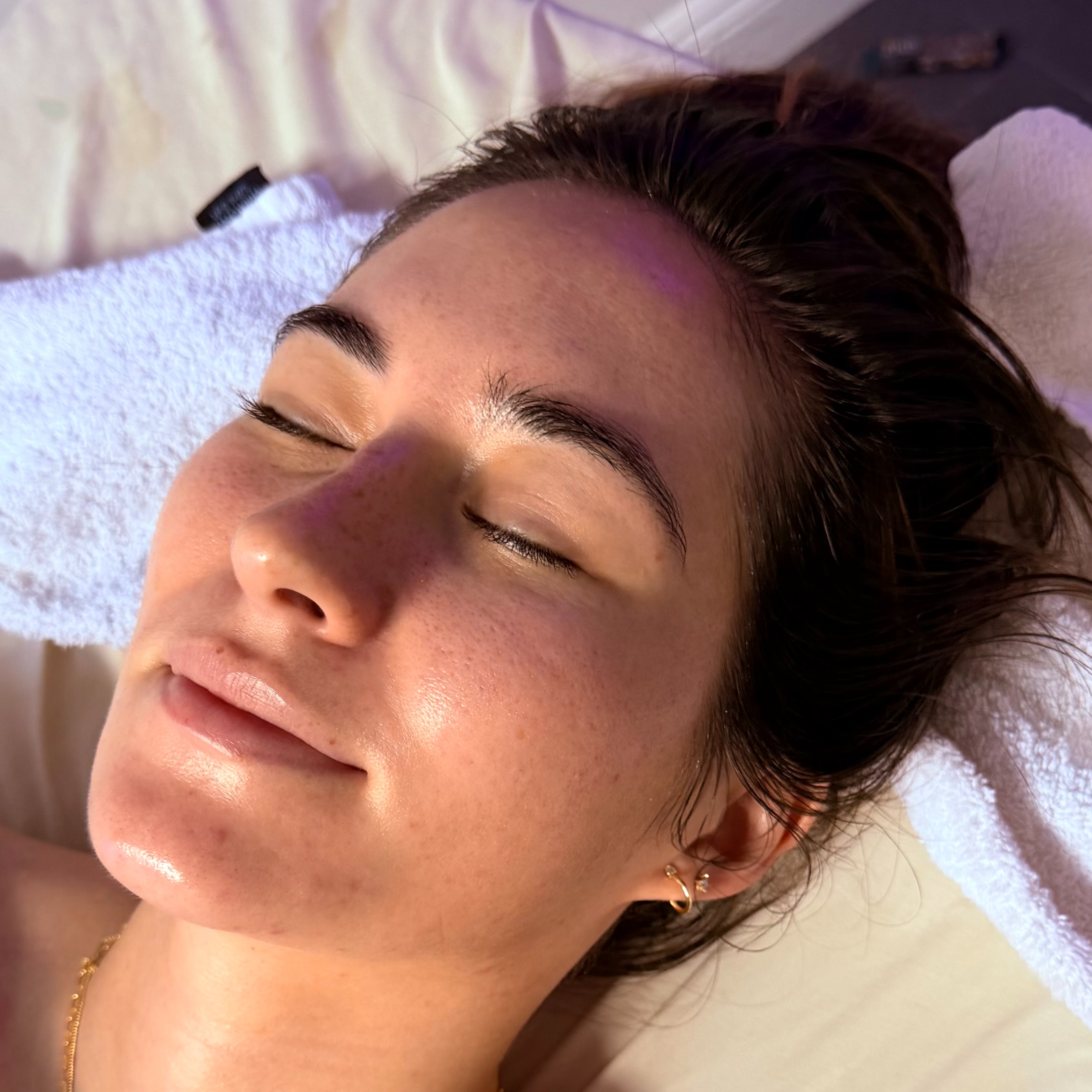 Acne Bootcamp- in person and online at Luxe O.C. Beauty in Orange, CA