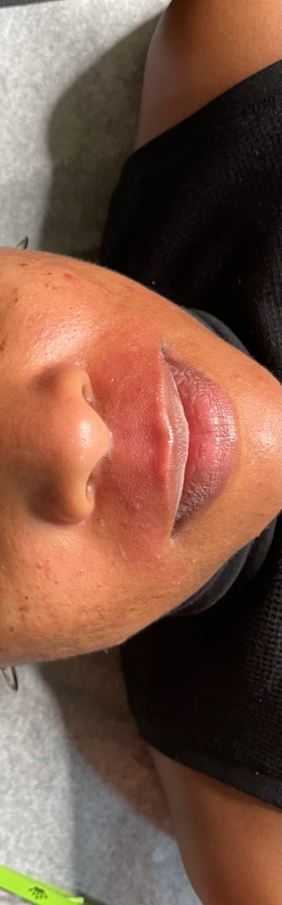 Lip
