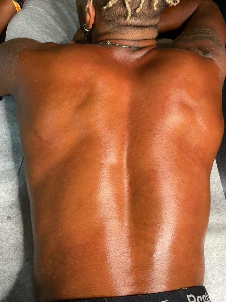 Back