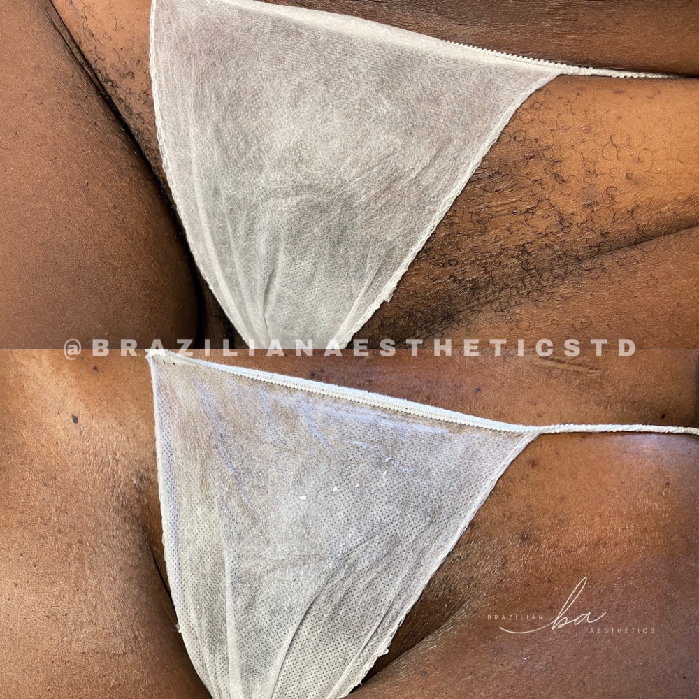 Bikini Wax