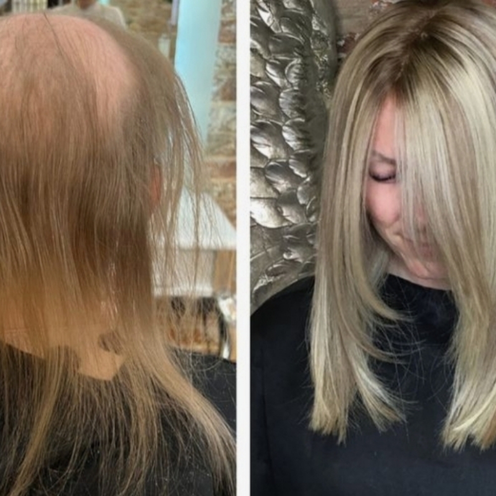 Hair Replacement Consultation at C. Alexander Artistry in Rapid City, SD