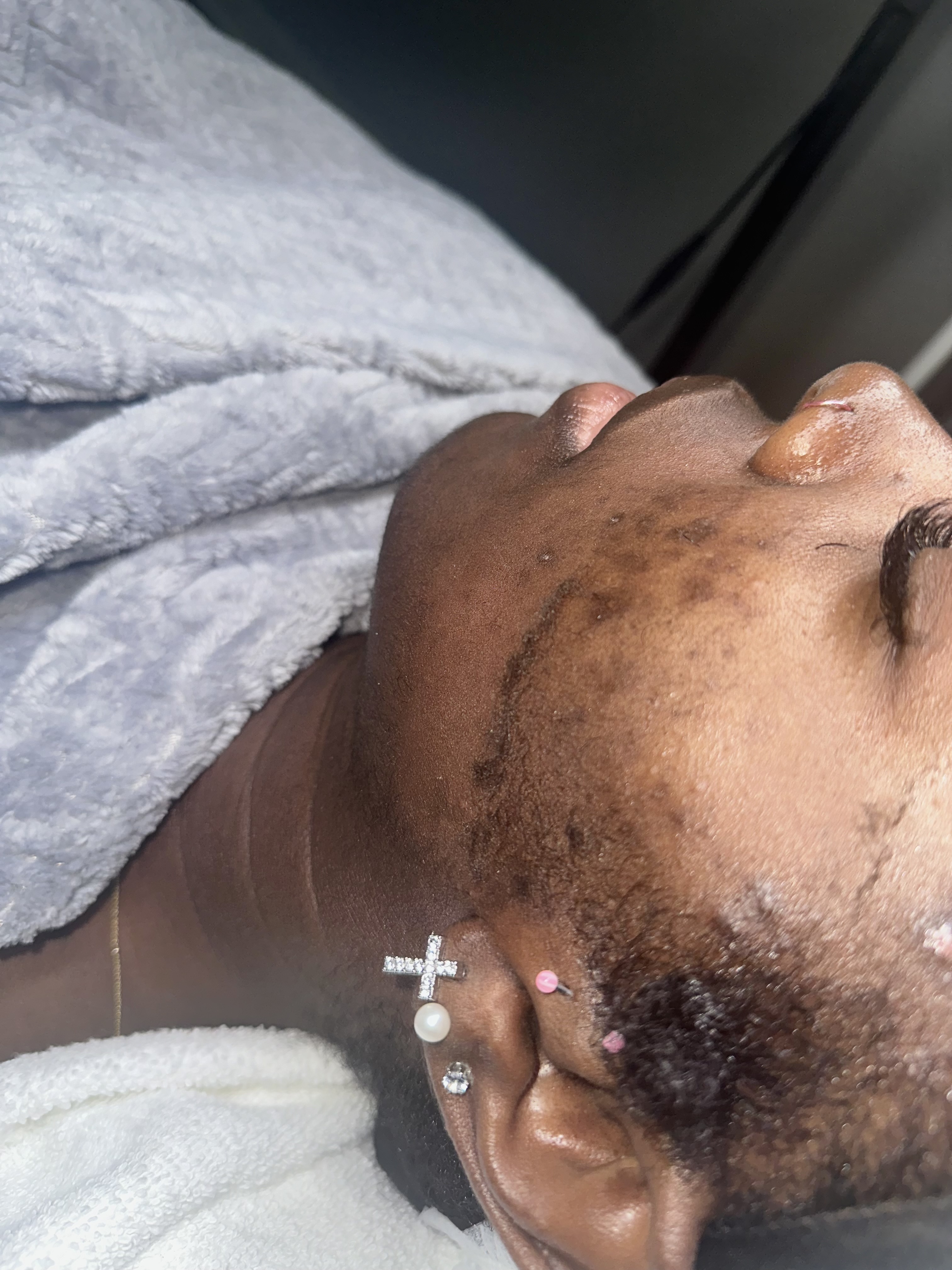 +Dermaplaning (Add-On)