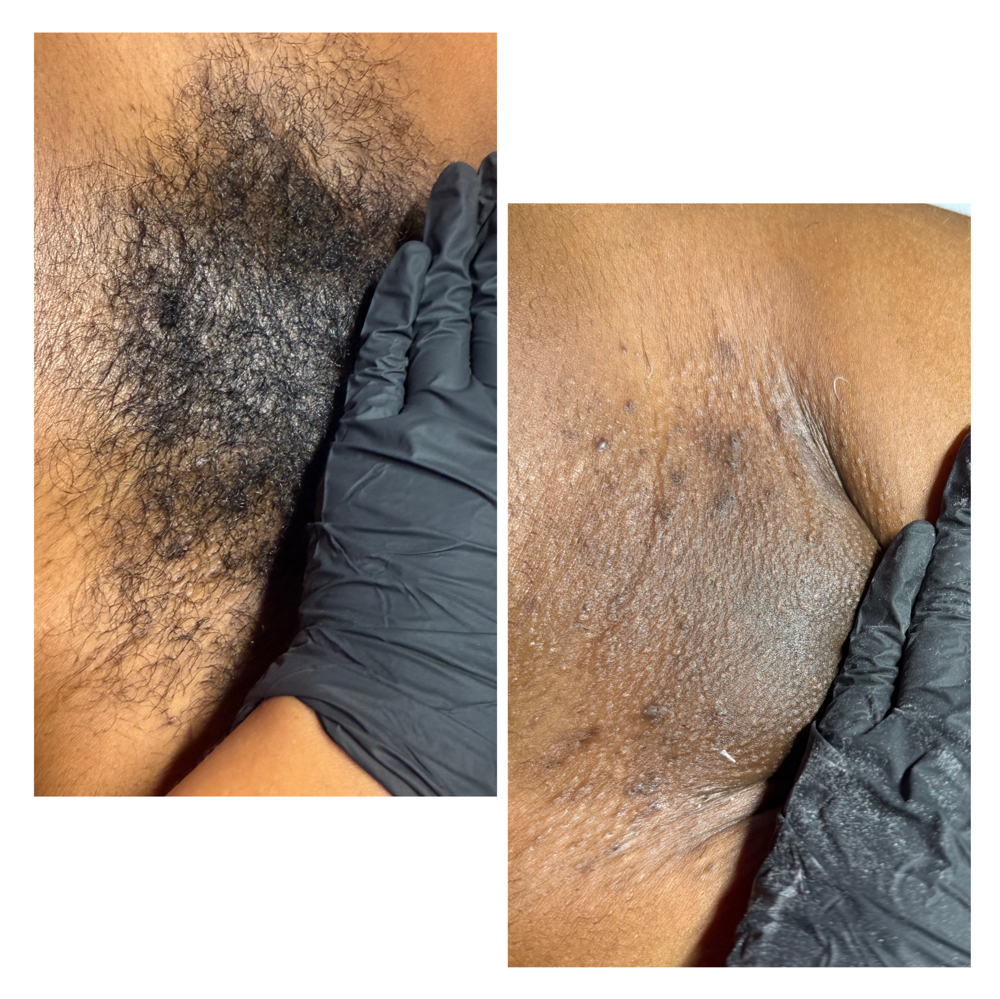 Brazilian Wax (First Time Client)