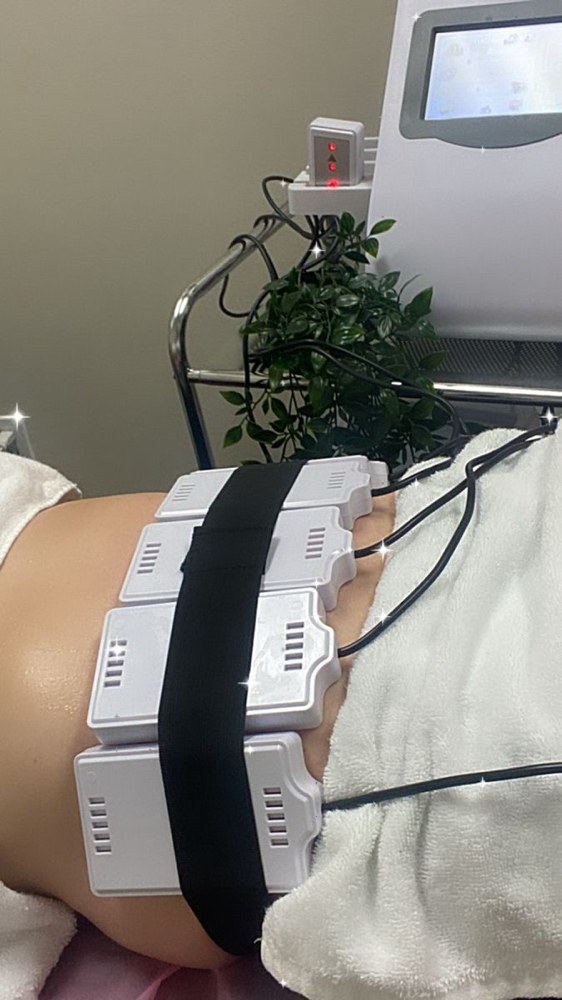 Lipo Laser at Des Beauty & Skin in El Paso, TX