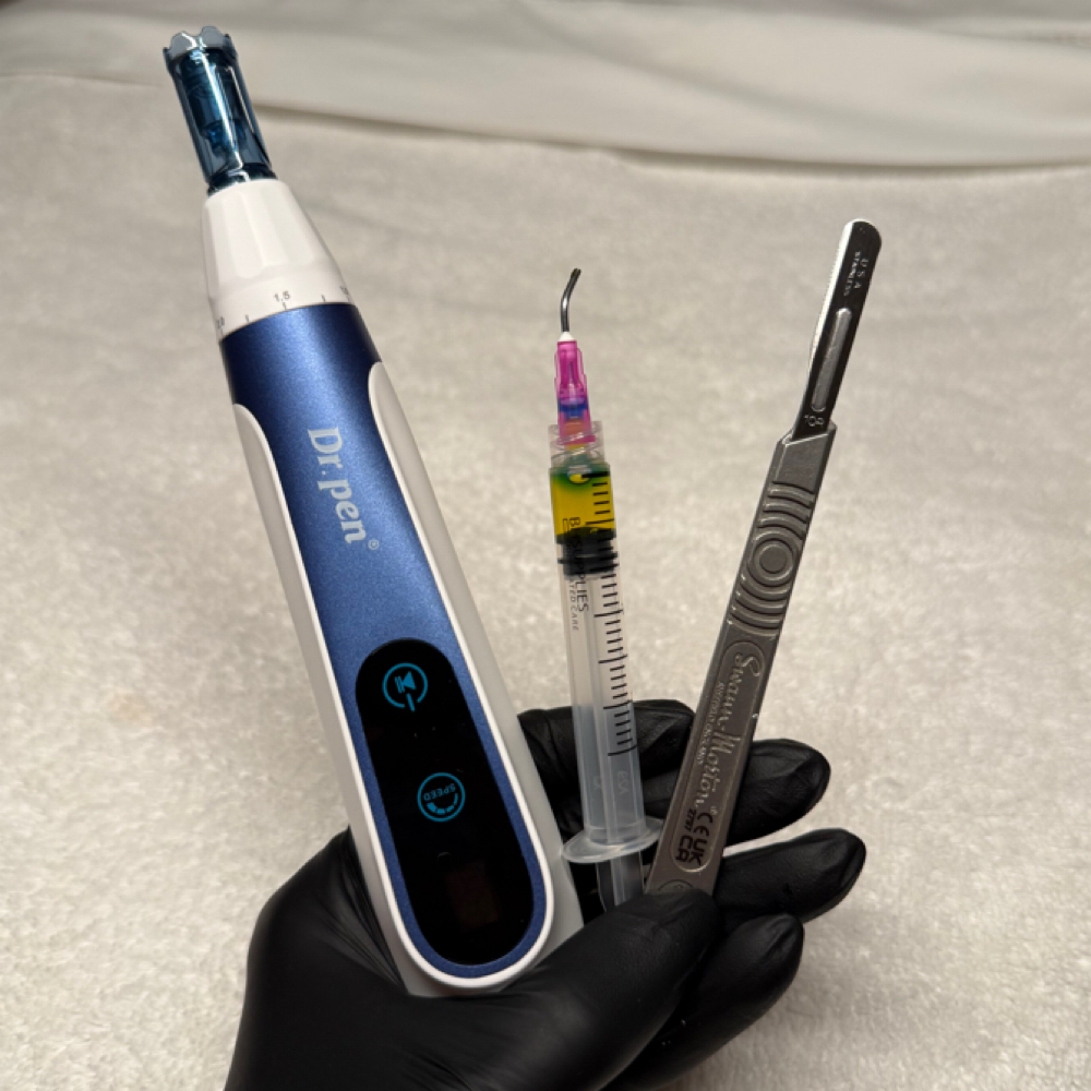 Microneedling with BioRePeel at Beauty by Korynn in Rocky Point, NY