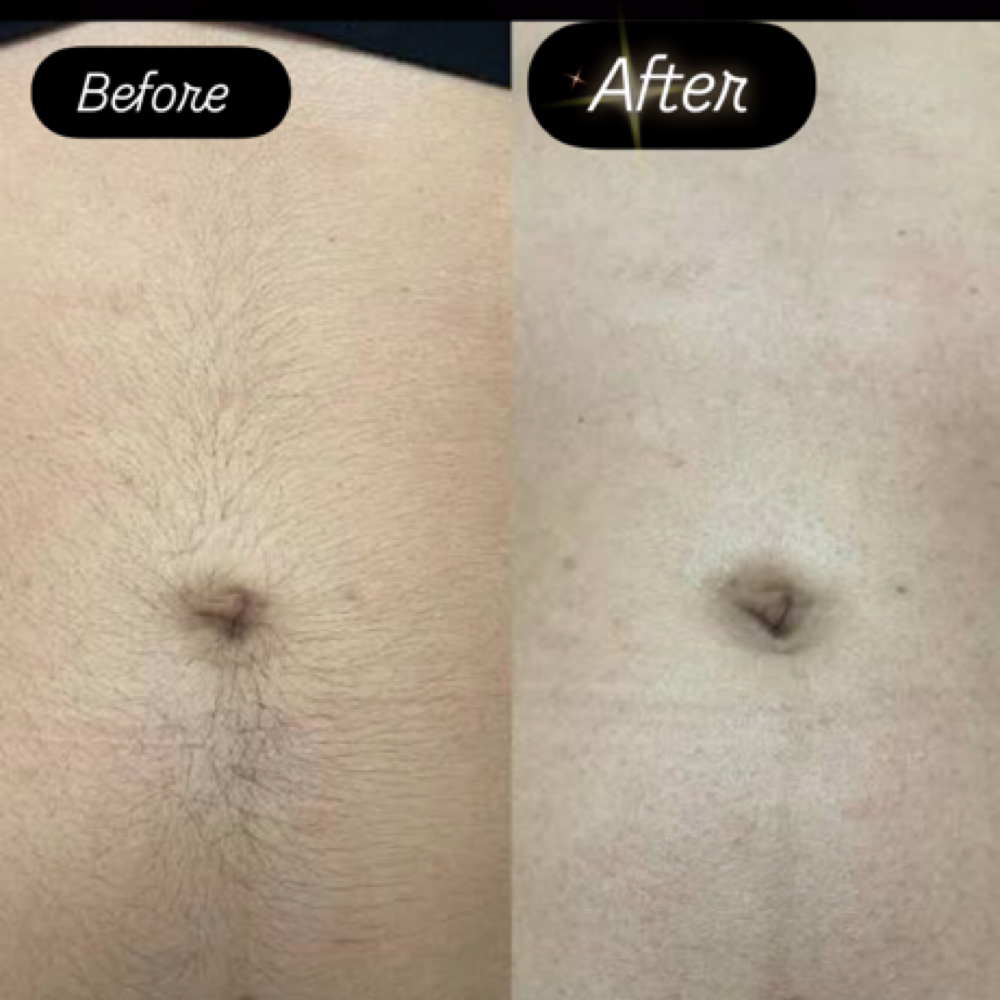Stomach Wax at Queensmade Esthetics in Wilmington, NC