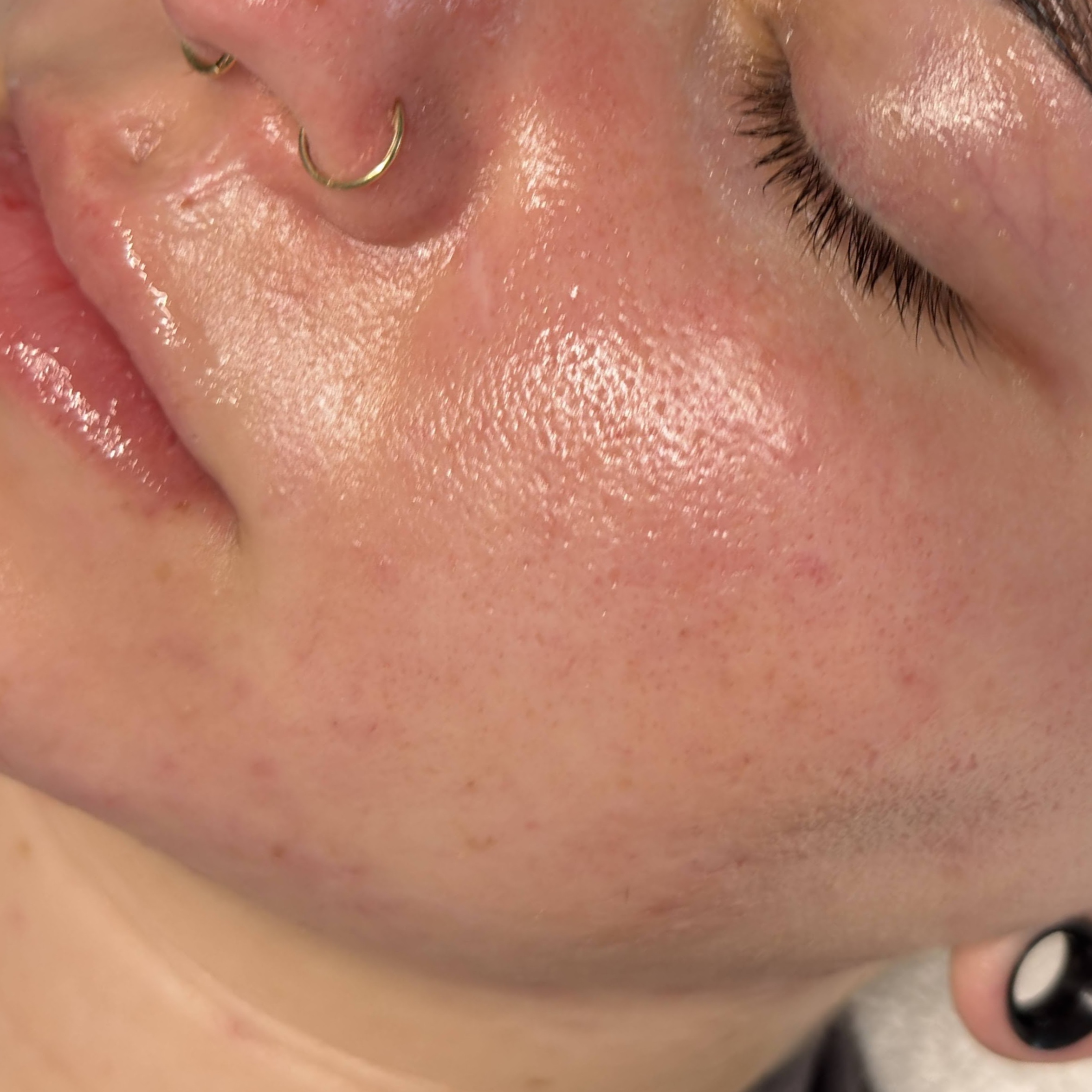Bio MINI Derma Facial at Bio Skin Aesthetics in Boise, ID