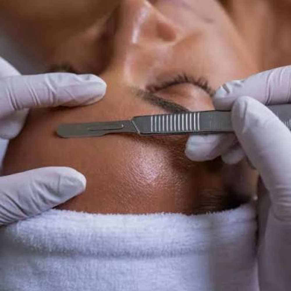 Dermaplaning Facial at Immaculate Beauty Bar in Terrell, TX