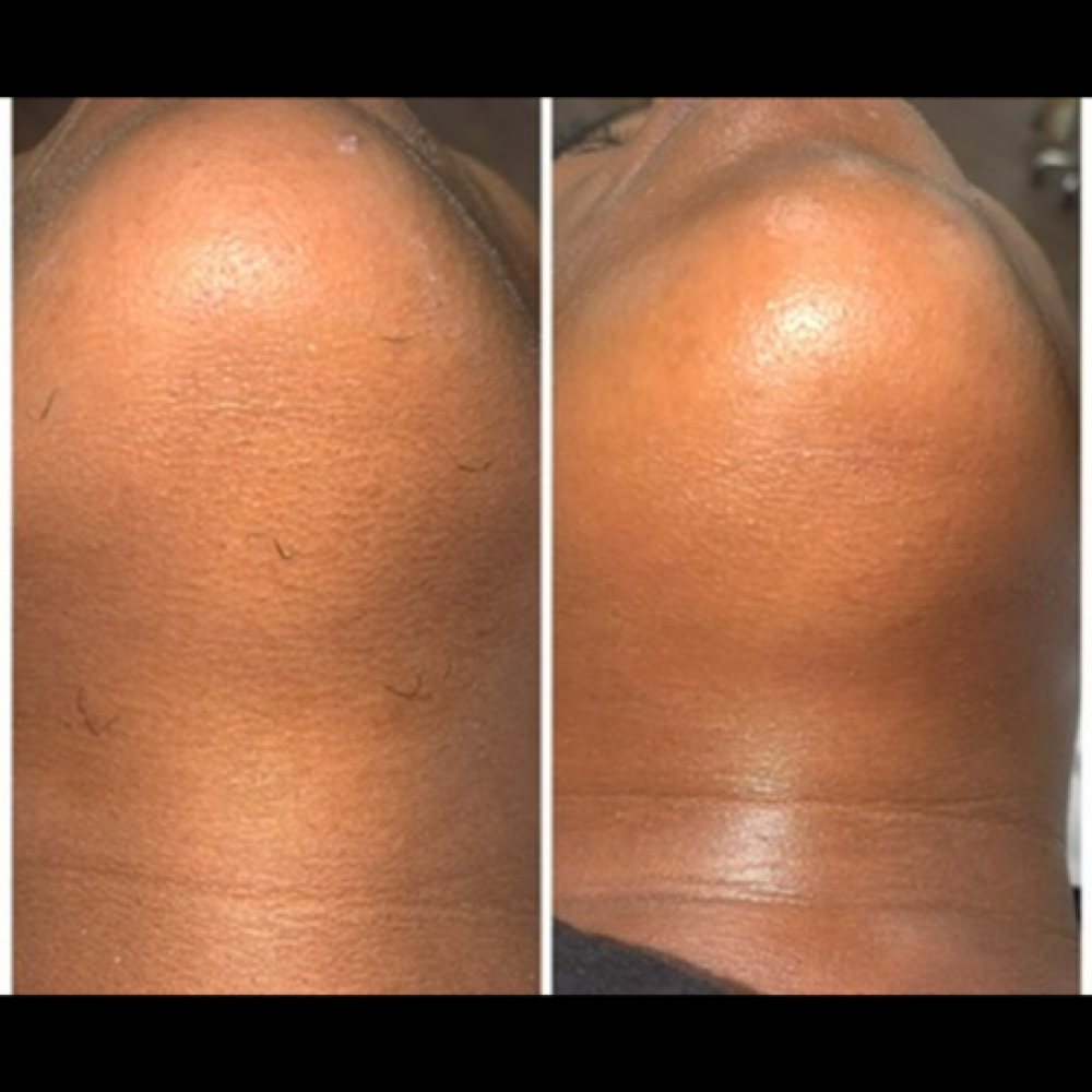 Chin at Sweet Escape Studio in Matteson, IL