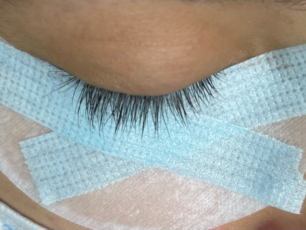 Lash Removal
