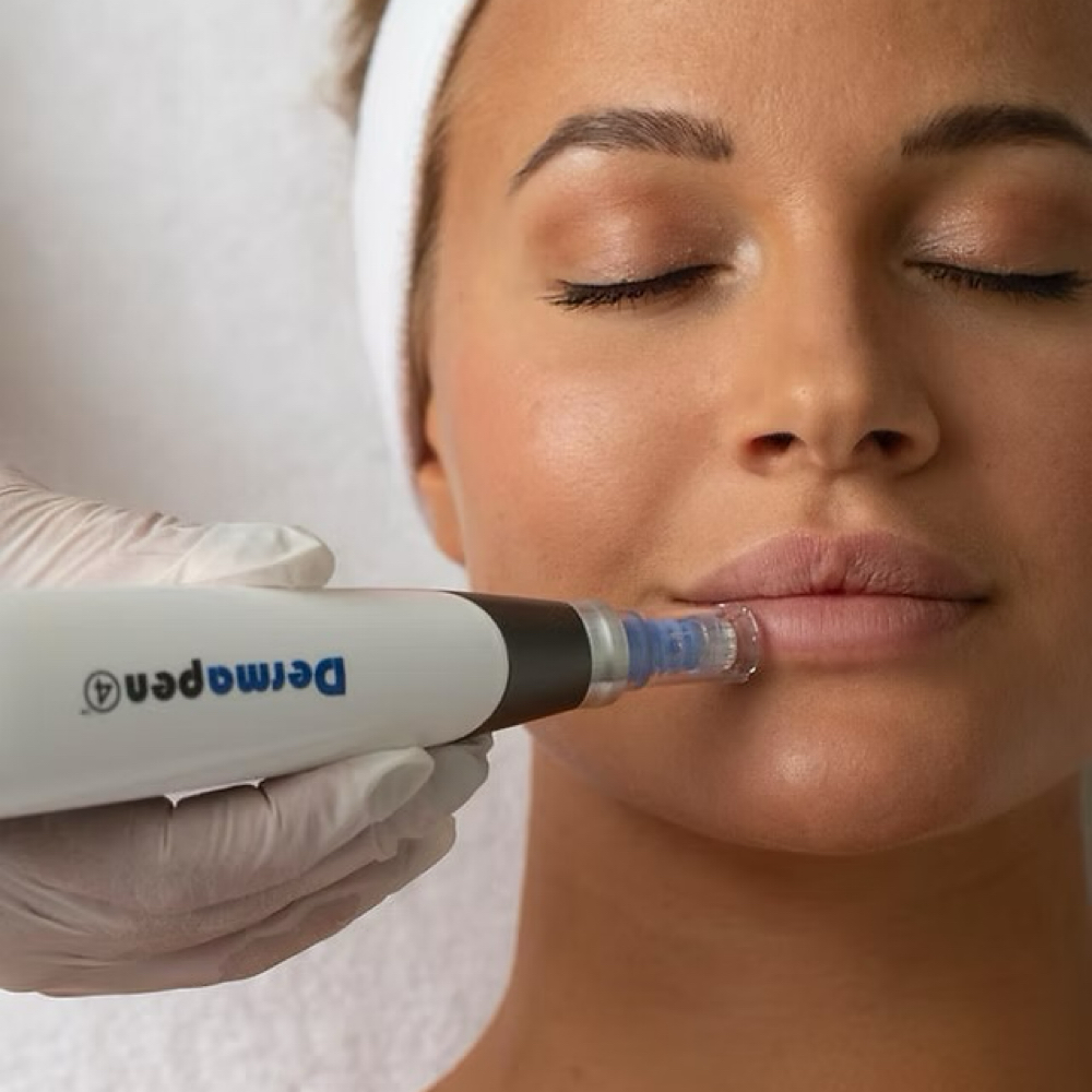 Microneedling + Dermaplane at The Fishers Esthetician in Fishers, IN