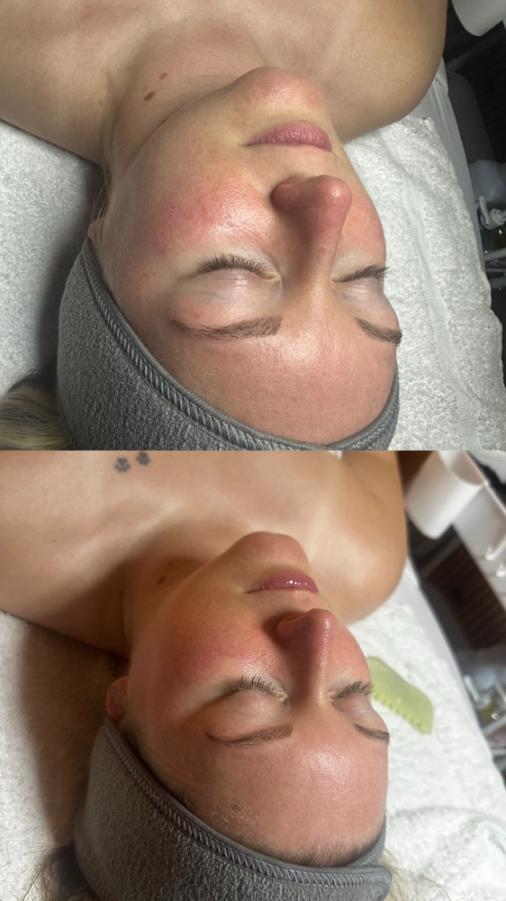Hydrating Facial