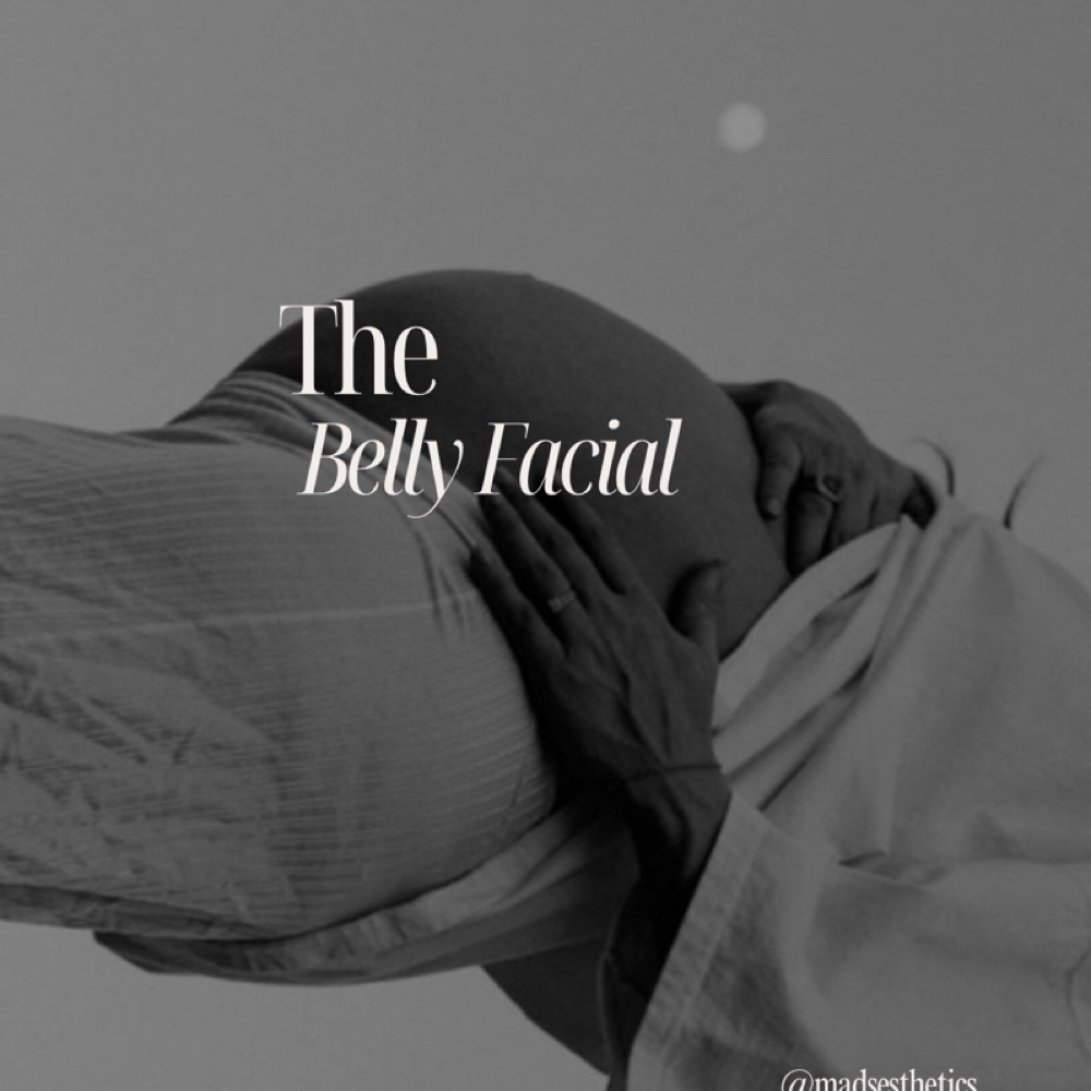 Belly Facial at Madsesthetics LLC in Litchfield Park, AZ
