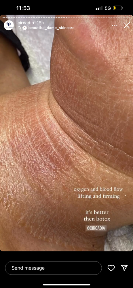 Better Than Botox at MP Aesthetics & Beauty LLC in Foley, AL