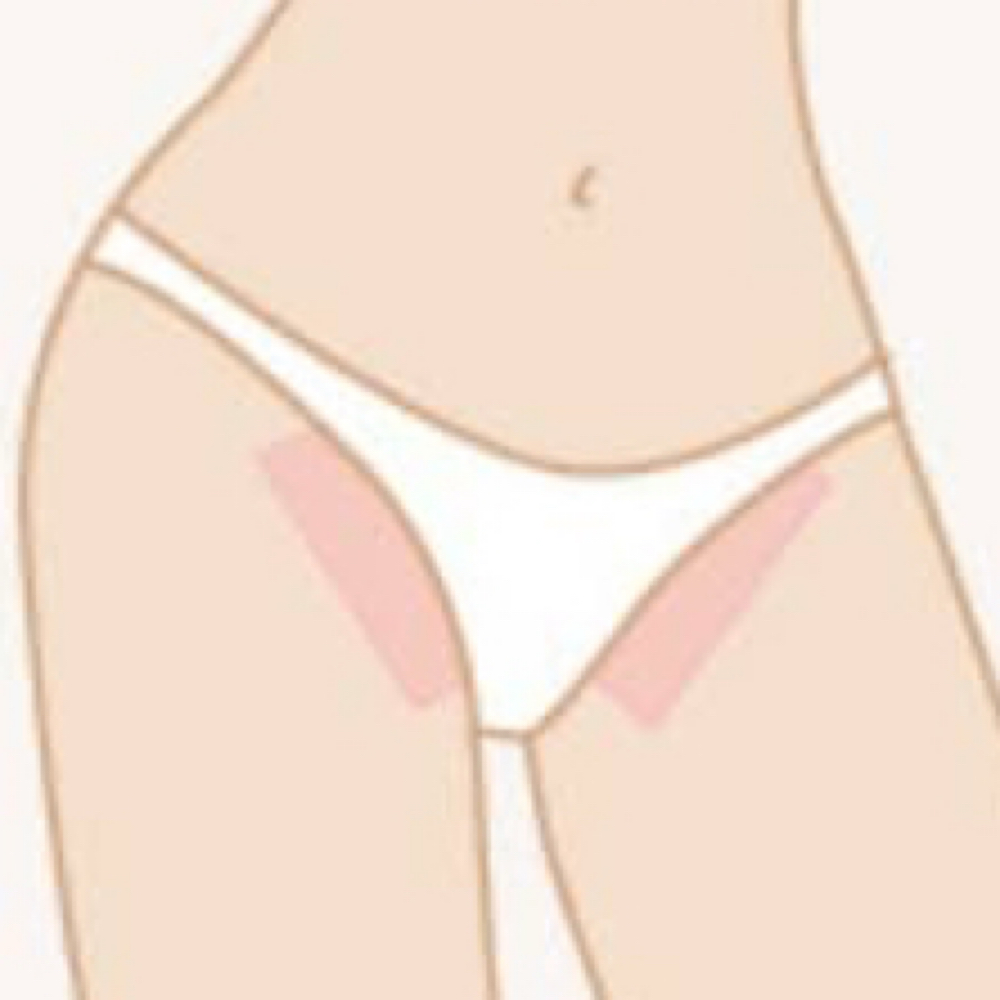 BIKINI LINE WAX at arbesthetics in dorcester, MA
