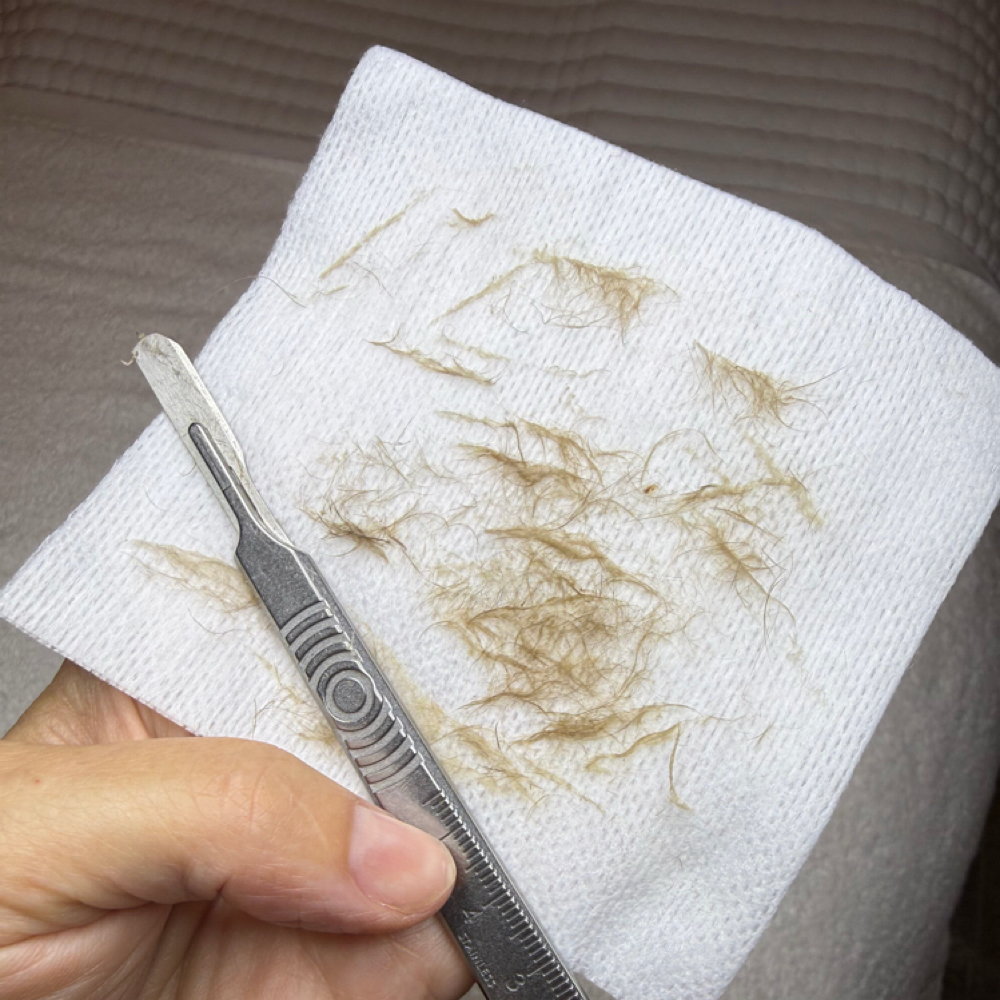 Dermaplane Mini Facial at Jenni Leanne Aesthetics in Temecula, CA
