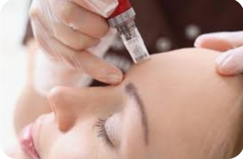 Nano/Micro Needling