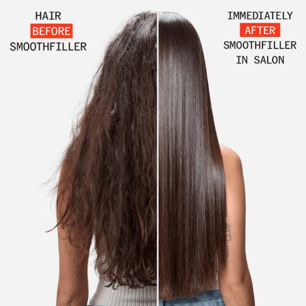 Smooth Filler Treatment at Embrace Your Glow in Williamsville, NY