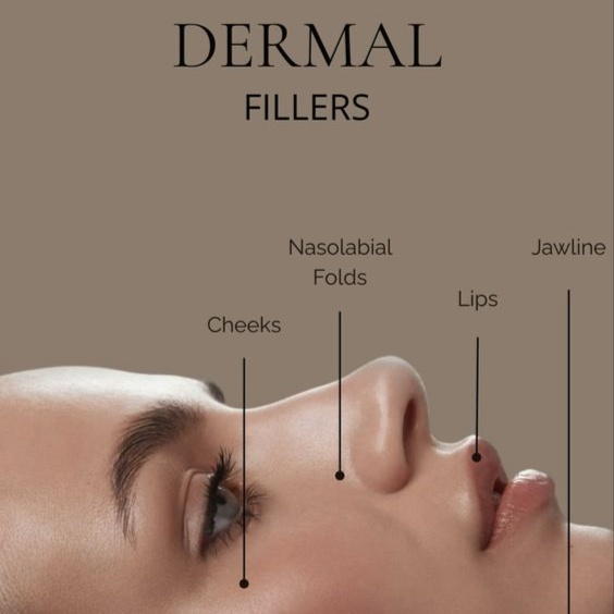 Dermal Filler at INANA MED SPA in Frisco, TX