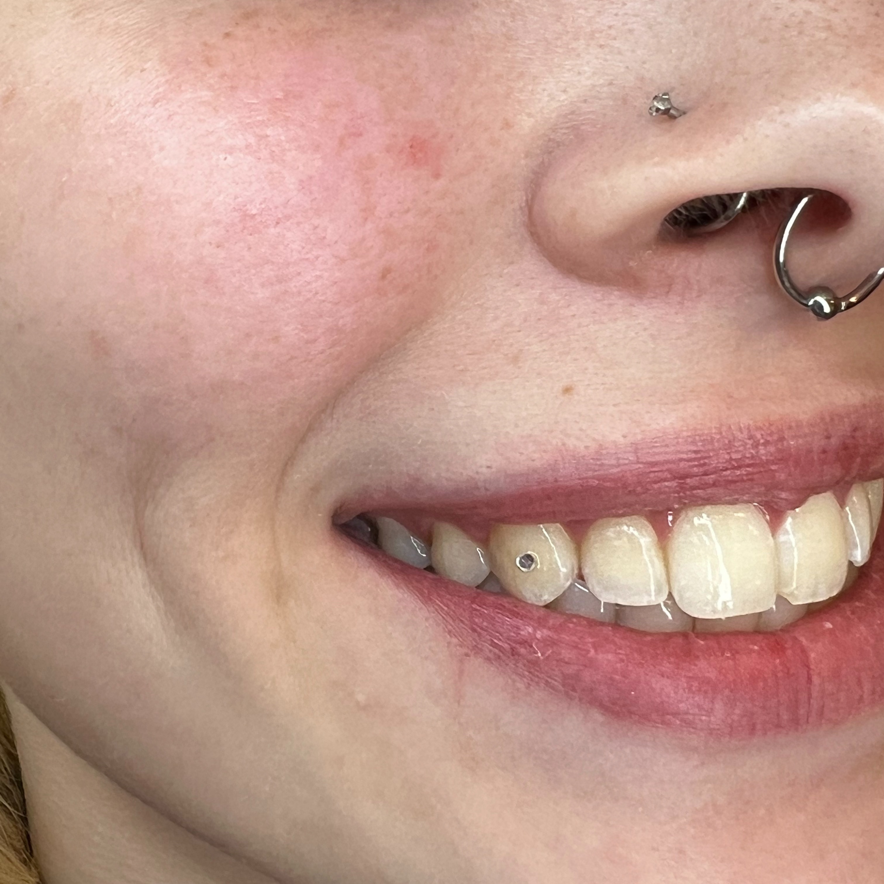 Tooth Gem: Medium at Glo Co Beauty Studio in Manchester, NH