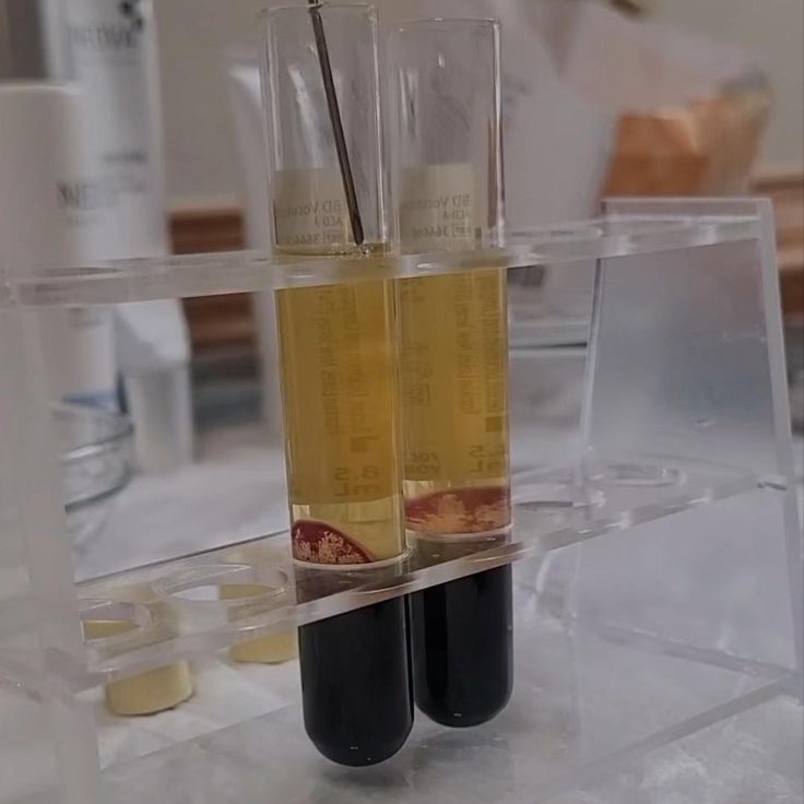 PRP Full-Face Rejuvenation at Pleasures of Beautee in Atlanta, GA