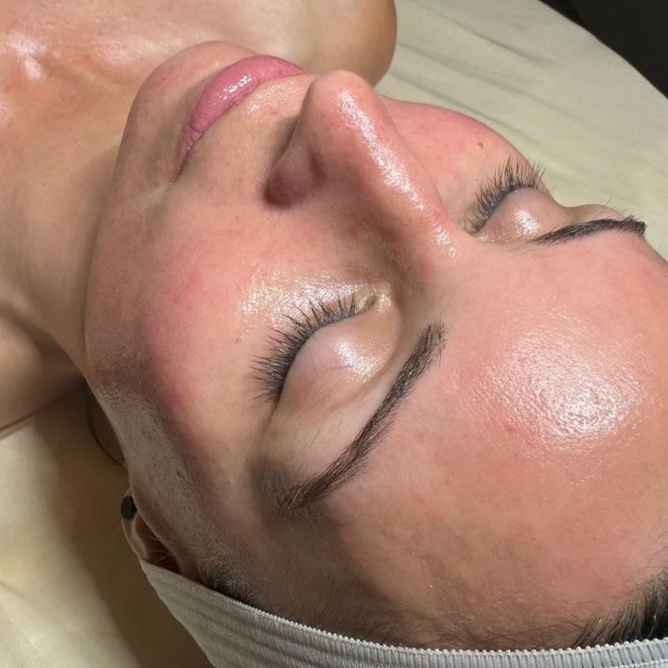 Bare Renewal Collagen Facial at Bare Studio in Cedar Park, TX