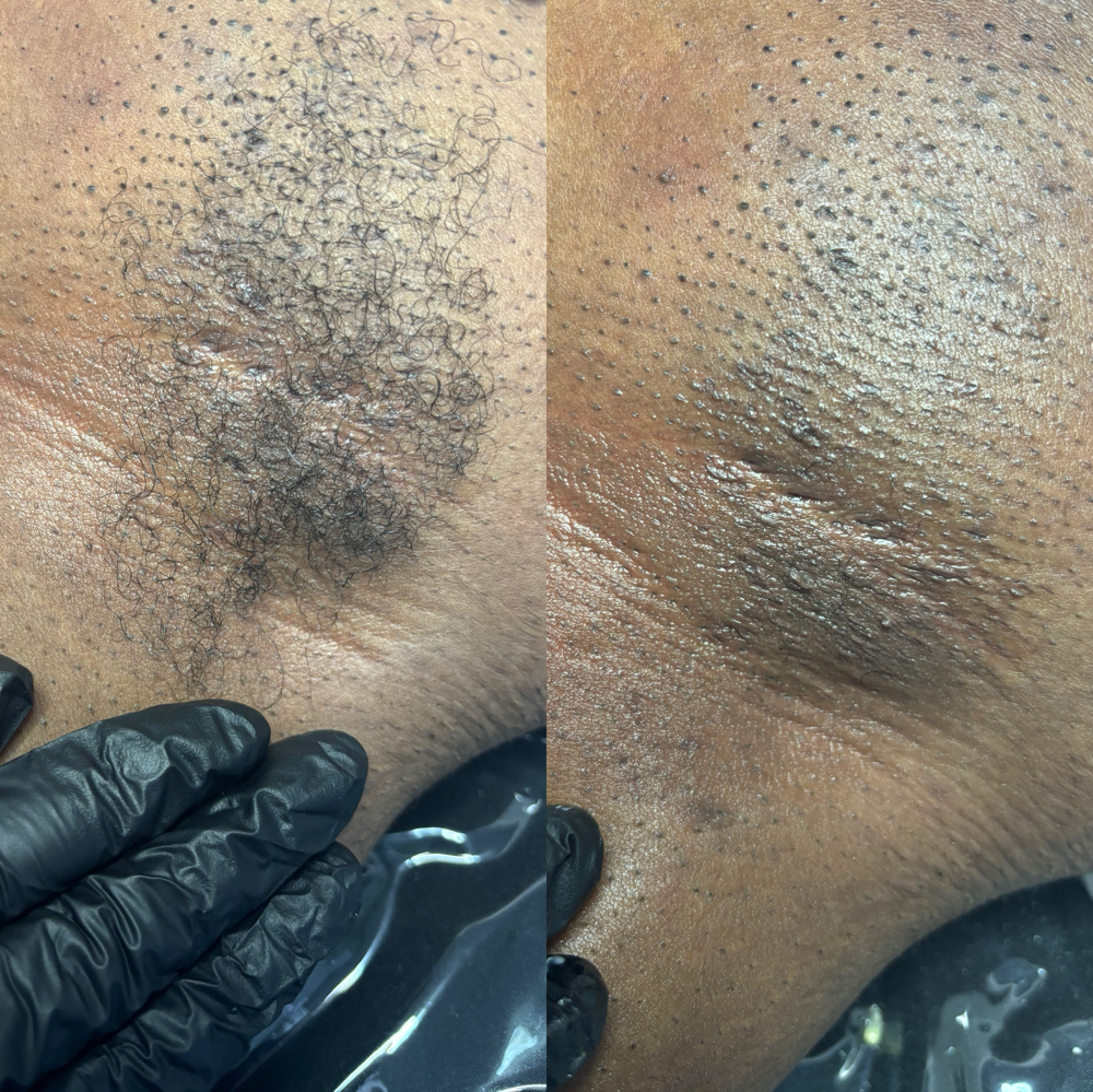 Underarm Wax at FACED AESTHETICS in Riverdale, GA